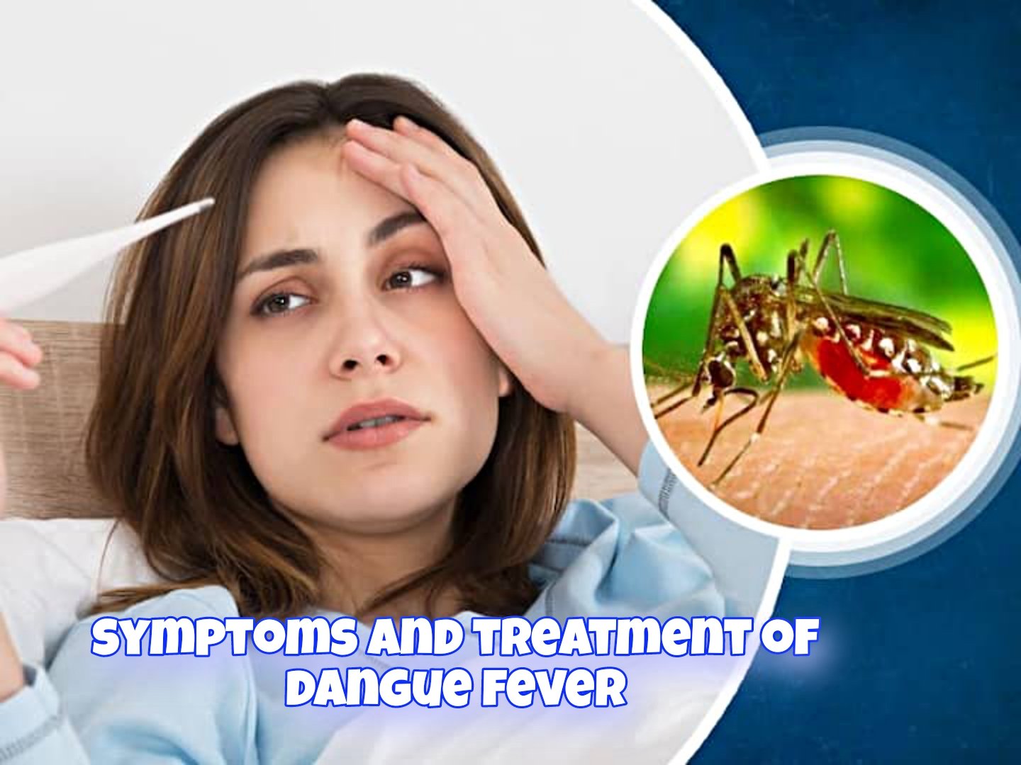 Explain 20 dengue fever symptoms and their treatment